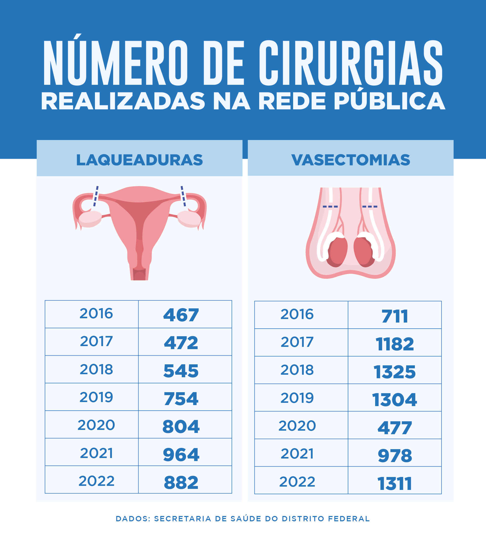 Laqueadura Tubária - Instituto Feminina - Cirurgia ginecológica