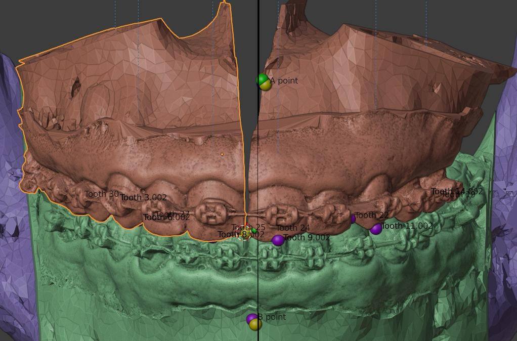 Hospital de Base é referência em cirurgias bucomaxilofaciais de alta complexidade&nbsp;