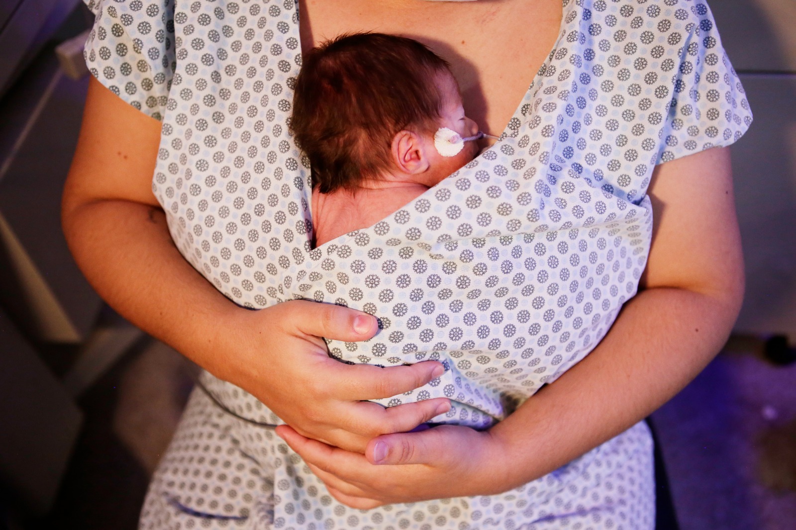 Método Canguru é técnica bem-sucedida com prematuros