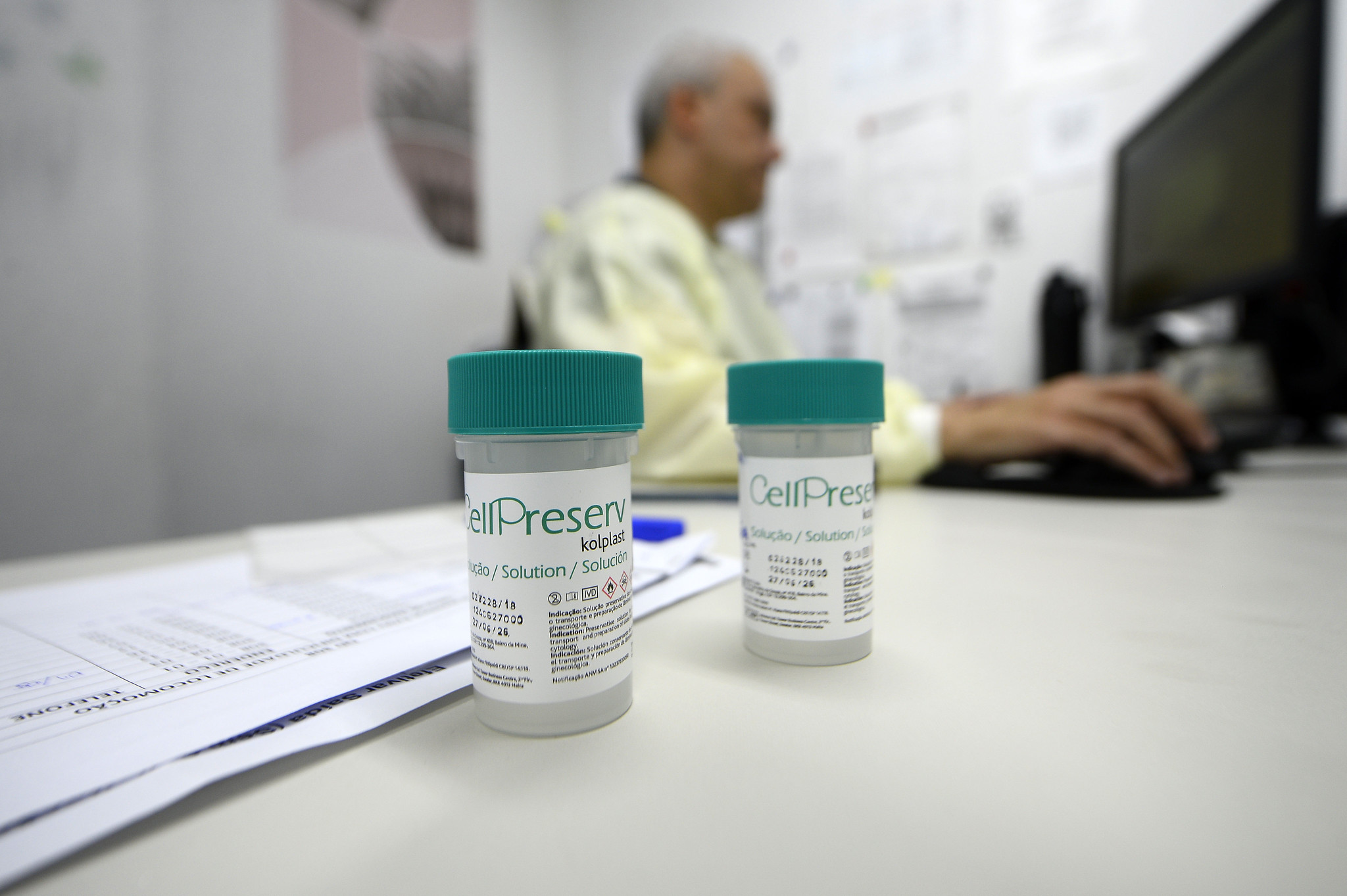 Teste de DNA-HPV na rede pública ajuda na prevenção do câncer de colo do útero