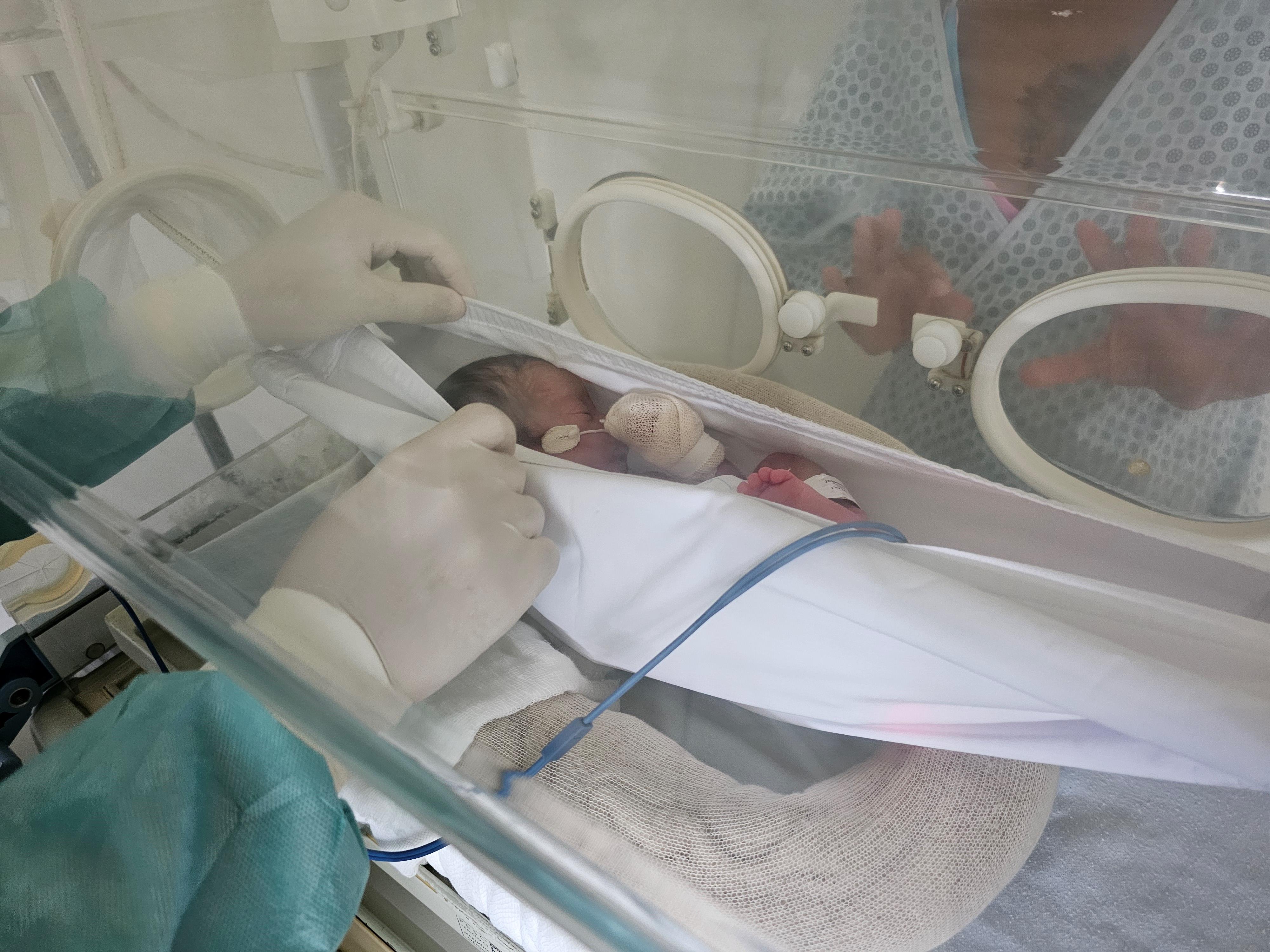 Redinhas são utilizadas no HRSM como forma de estimulação de recém-nascidos