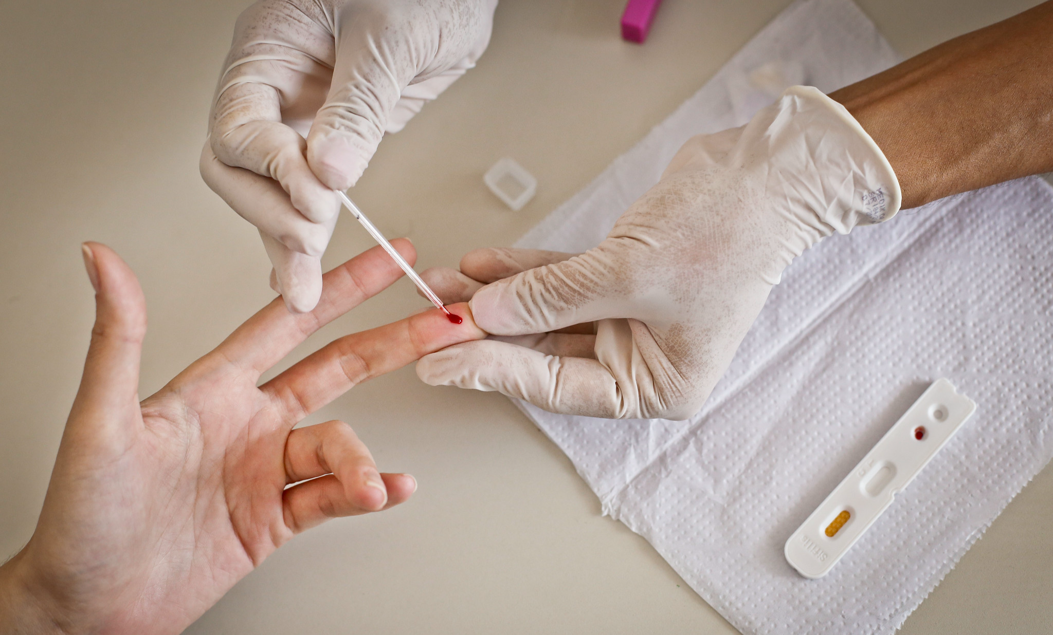 Preconceito contra pacientes com HIV ainda afasta pessoas de diagnóstico e cuidado