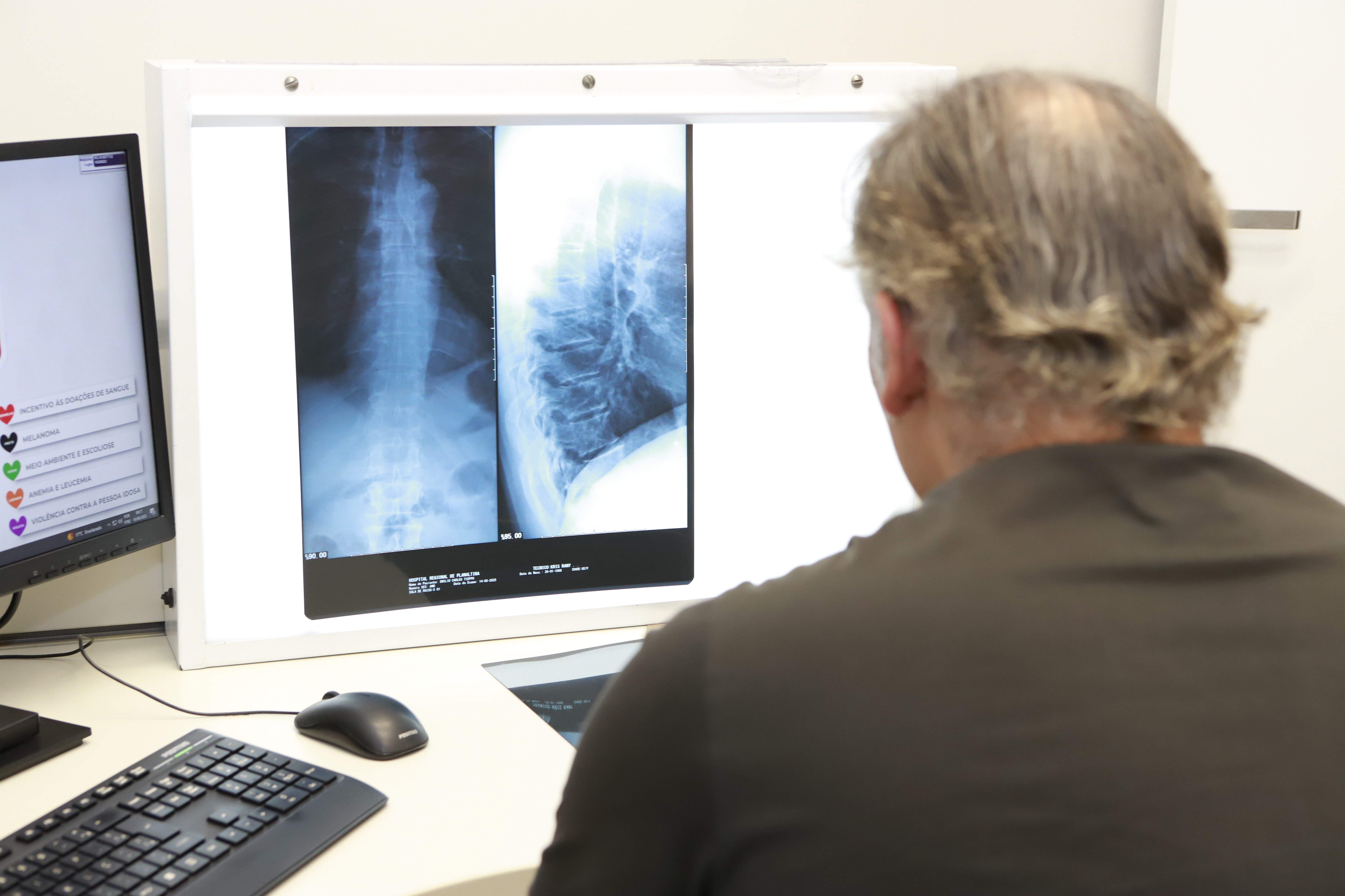 Audiência pública vai debater padronização de raio-X fixo digital nos hospitais do DF