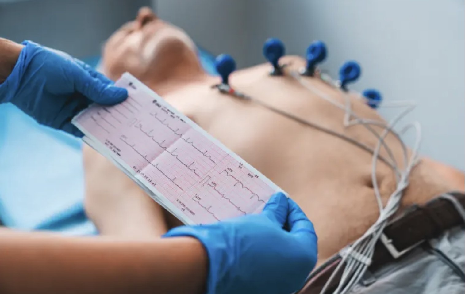 Saúde alerta para a importância de hábitos saudáveis na prevenção da insuficiência cardíaca