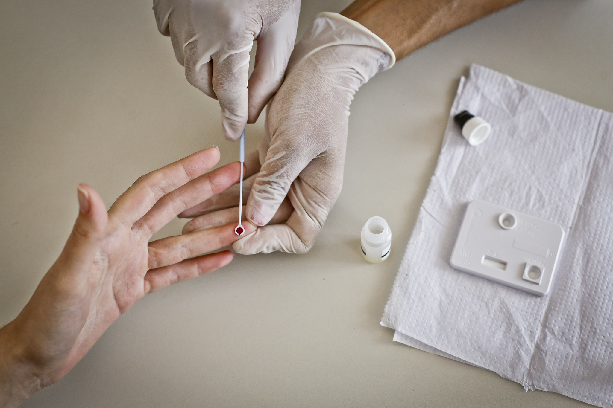 Informação e testagem são aliadas na prevenção de HTLV