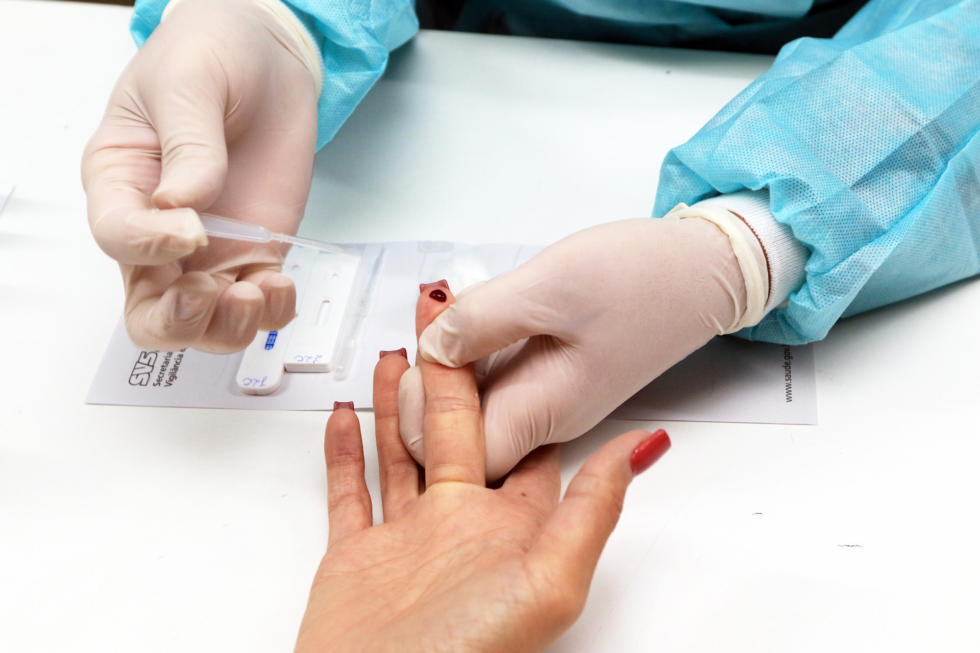 Saúde sexual: UBSs do Distrito Federal fizeram mais de 212 mil testes rápidos neste ano