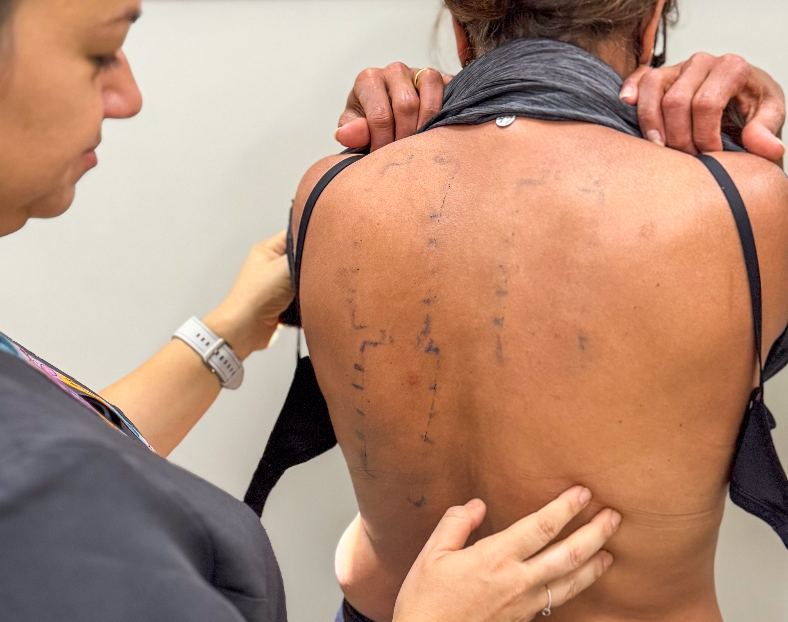 Hospital de Base devolve qualidade de vida a pacientes com dermatite atópica