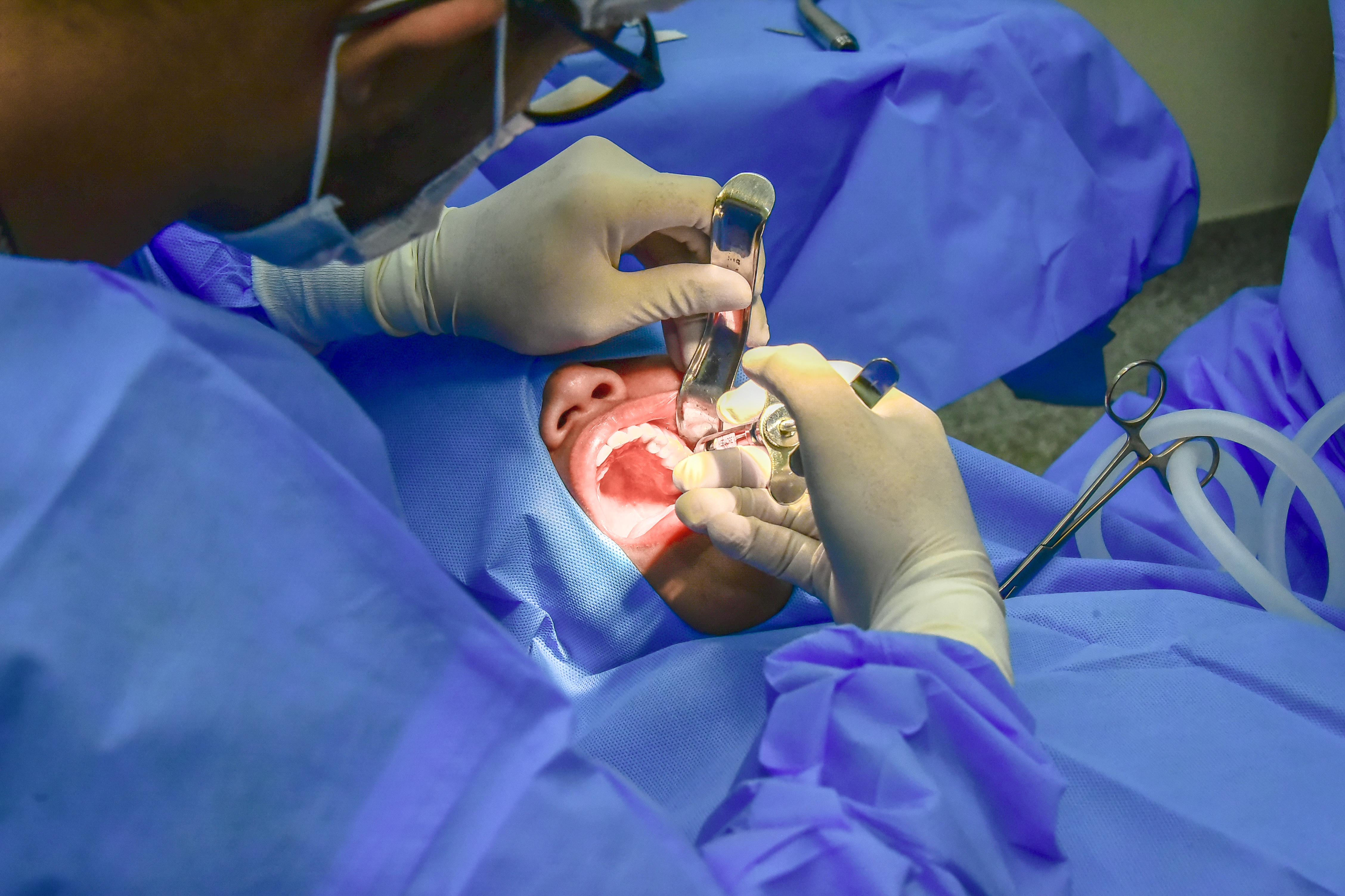 IgesDF está com edital aberto para aquisição de equipamentos odontológicos