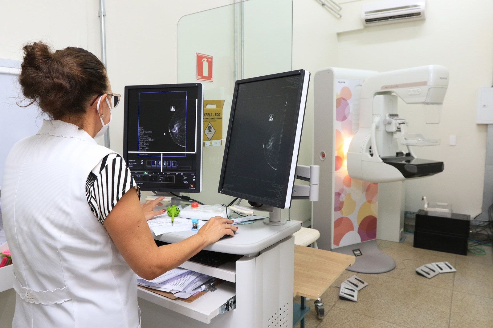 Mamografia tem papel fundamental no diagnóstico precoce do câncer de mama