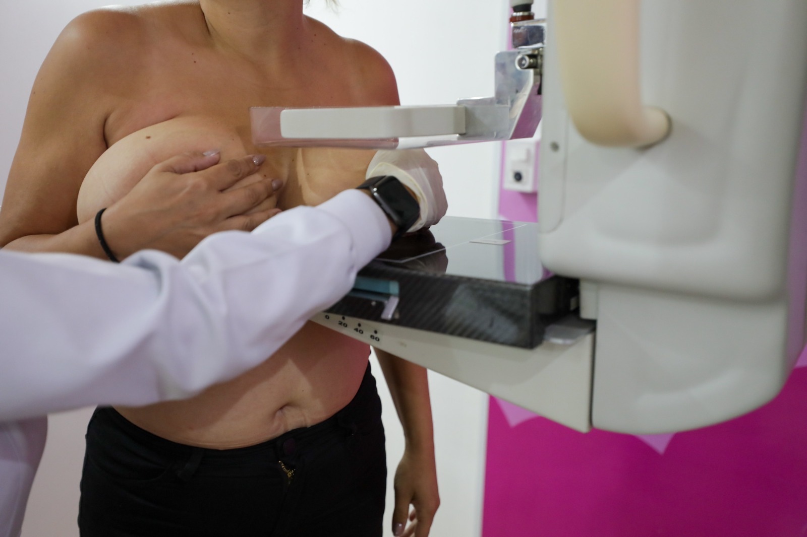 Hospital de Base realiza mais de 4,8 mil atendimentos de mastologia em 2025