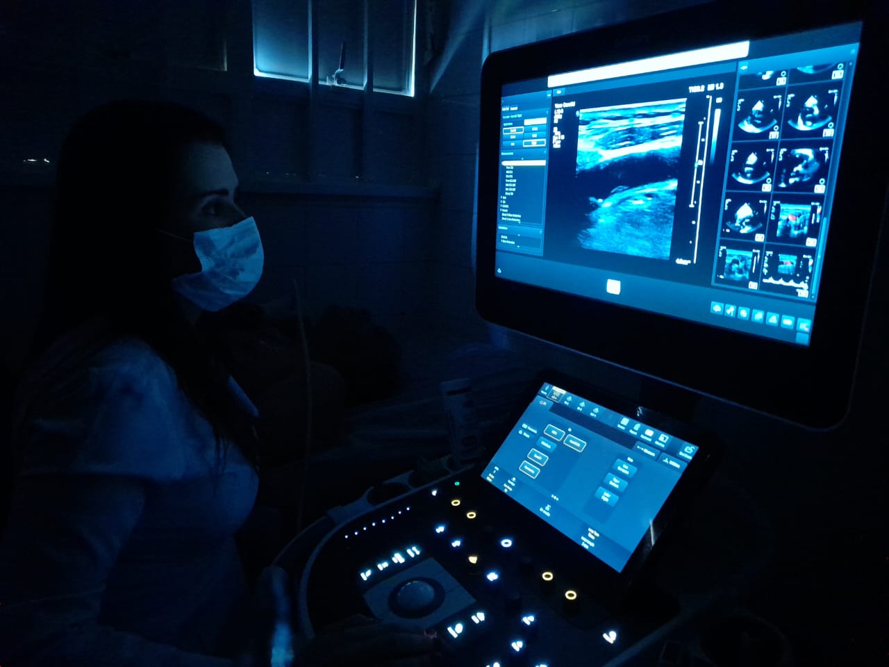 Novo equipamento agiliza exames cardíacos no Hospital Regional de Ceilândia