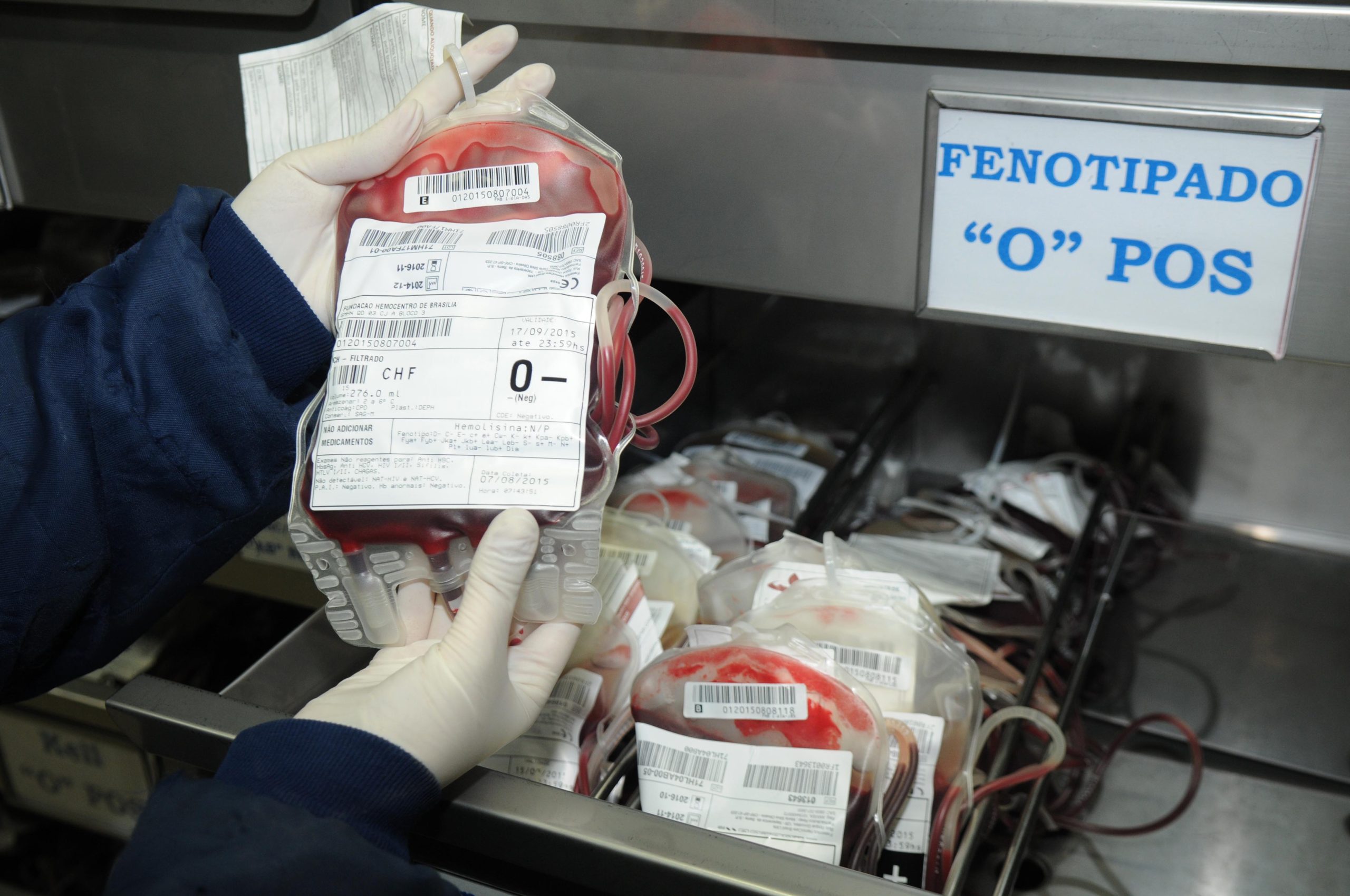 Evento estimula doação de sangue fenotipado para pacientes com doença falciforme